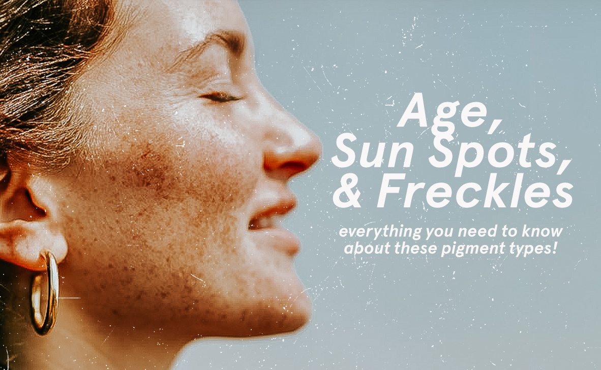 Everything You Need To Know About Brown Spots