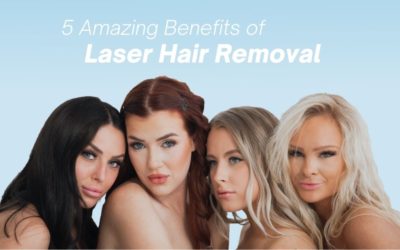 5 Amazing Benefits of Laser Hair Removal