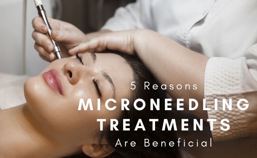 5 Reasons Microneedling Treatments Are Beneficial