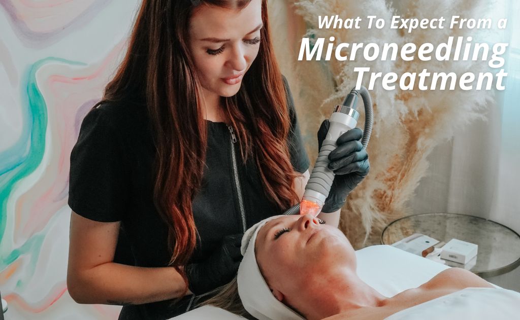 What To Expect From a Microneedling Treatment