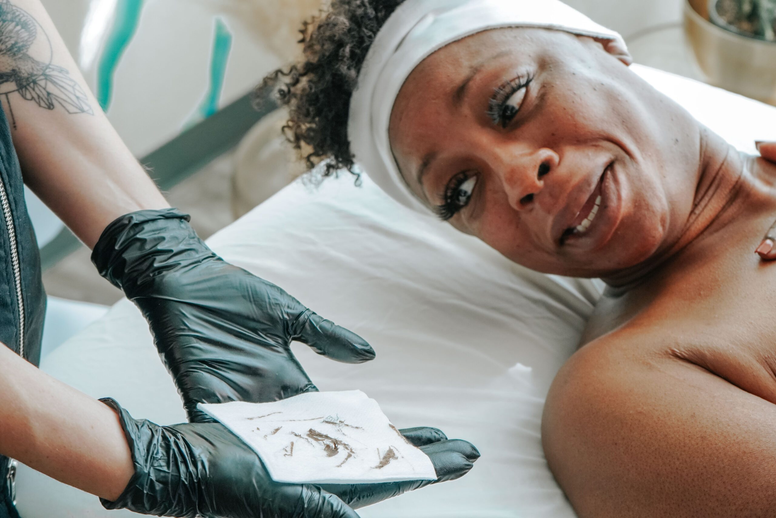 Dermaplaning